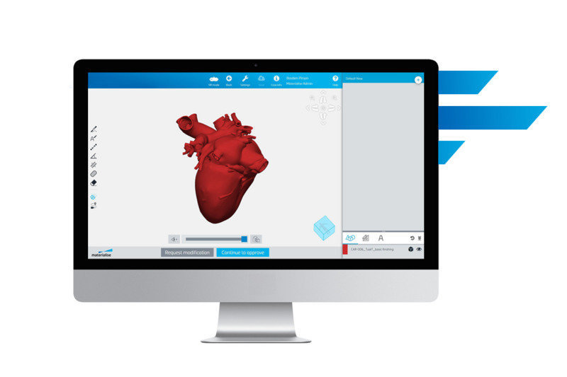 MATERIALISE INTRODUCES MIMICS FLOW CASE MANAGEMENT FOR HOSPITAL 3D PRINTING LABS